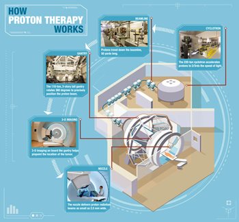 How Proton Therapy Works - Texas Center for Proton Therapy